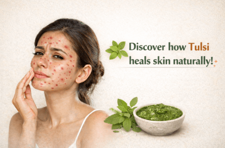 Clear acne and remove pimples. using tulsi