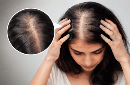 Thin Hair Visible Scalp