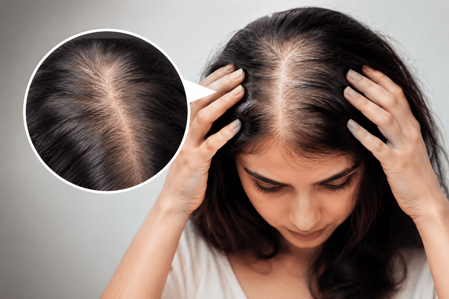 Thin Hair Visible Scalp